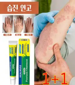 (본토출하)Herbal 1 1 피부 가려움증 한포진 습진 피부건조 알레르기 발포 습진 등의 증상 완화 연고, 20g * 2, 2개