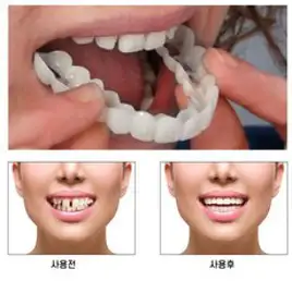 BT 1+1 치아 세트 (위니 + 아랫니 + 수납함), 1개